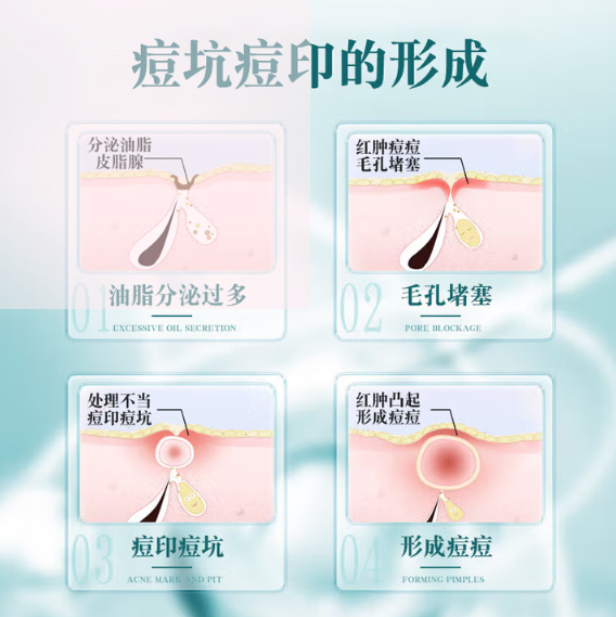 2025 去痘印产品权威排行榜:科学选品指南,精准淡化痘印痘坑